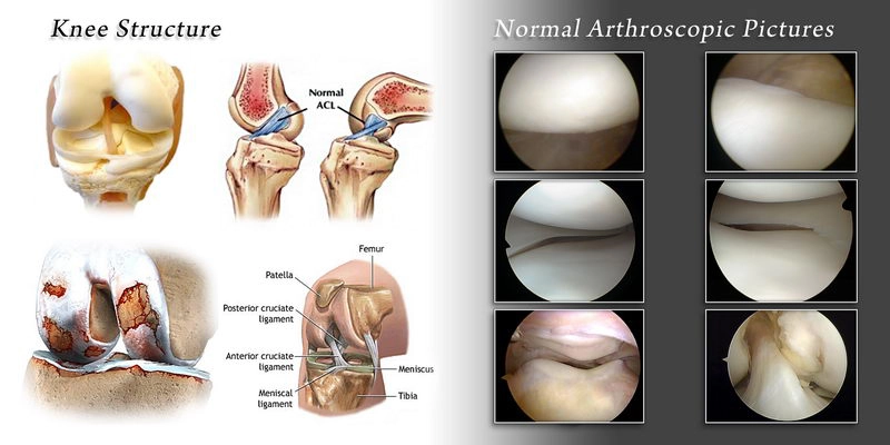 knee joint